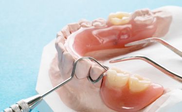 temporary partial denture