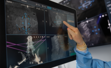teknologi robotik spine surgery