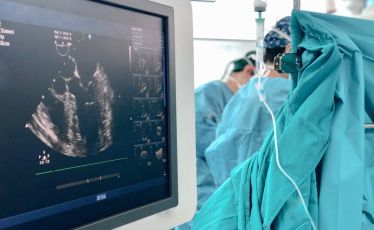 Transesophageal Echocardiogram (TEE)