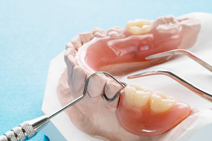  temporary partial denture