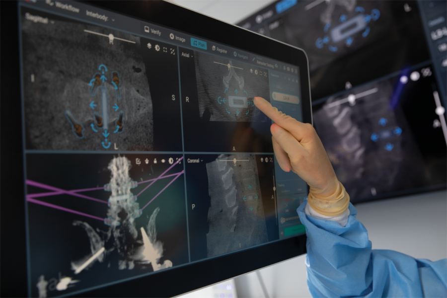 img src. globusmedical