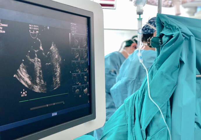Transesophageal Echocardiogram (TEE)