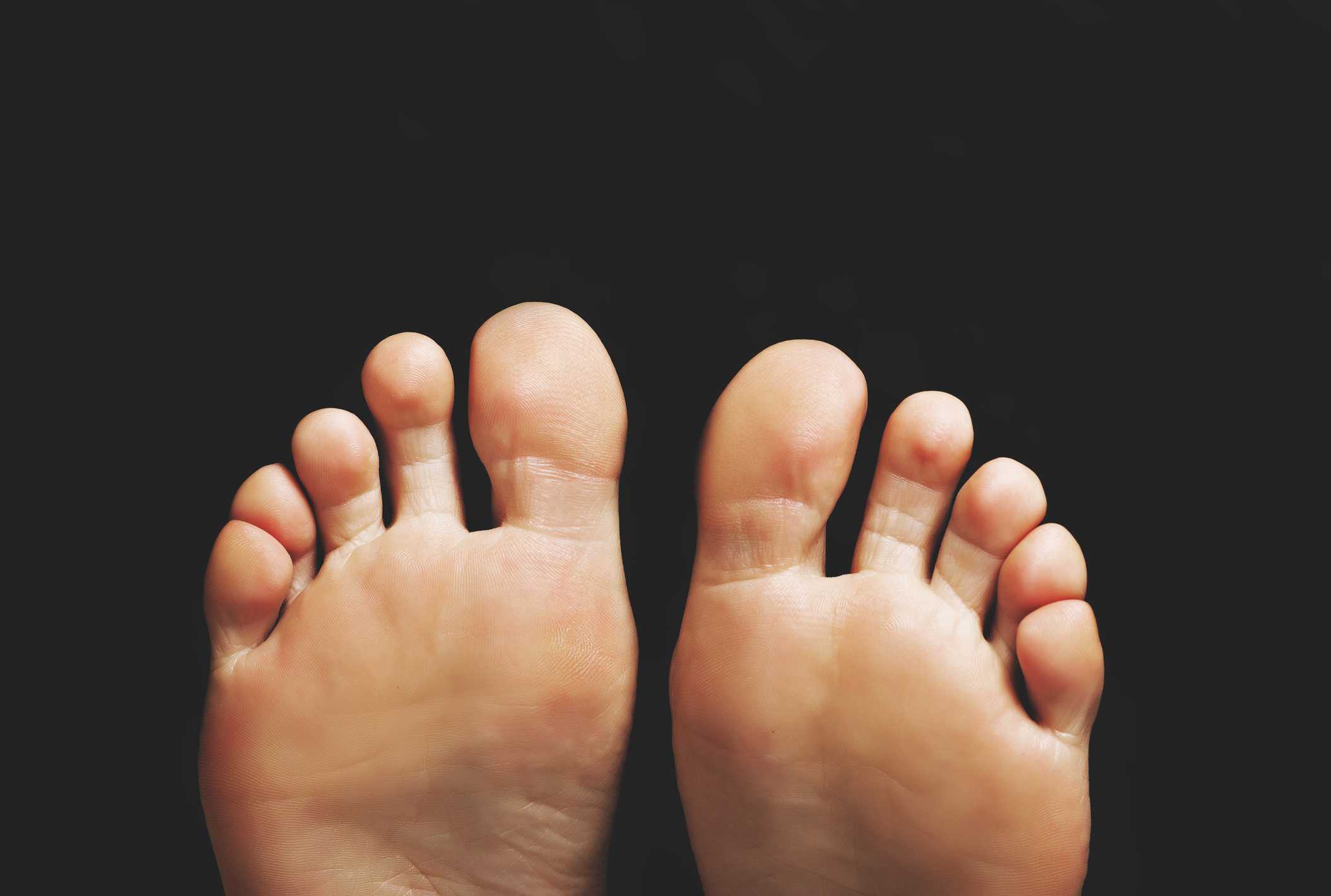 Kaki Diabetes Dan Tanda-Tandanya Premier Bintaro Hospital